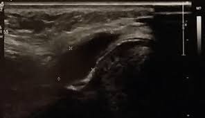 IDEAL SCAN CENTRE - MEDICAL LAB  & ECG