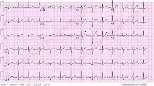 IDEAL SCAN CENTRE - MEDICAL LAB  & ECG